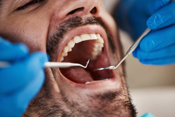 Best Tooth Infection Emergency Dentist  in Staunton, VA