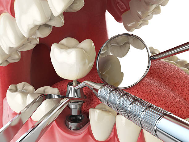 Best Knocked-Out Tooth Emergency  in Staunton, VA